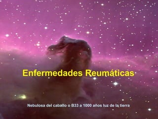 Enfermedades Reumáticas Nebulosa del caballo o B33 a 1000 años luz de la tierra 