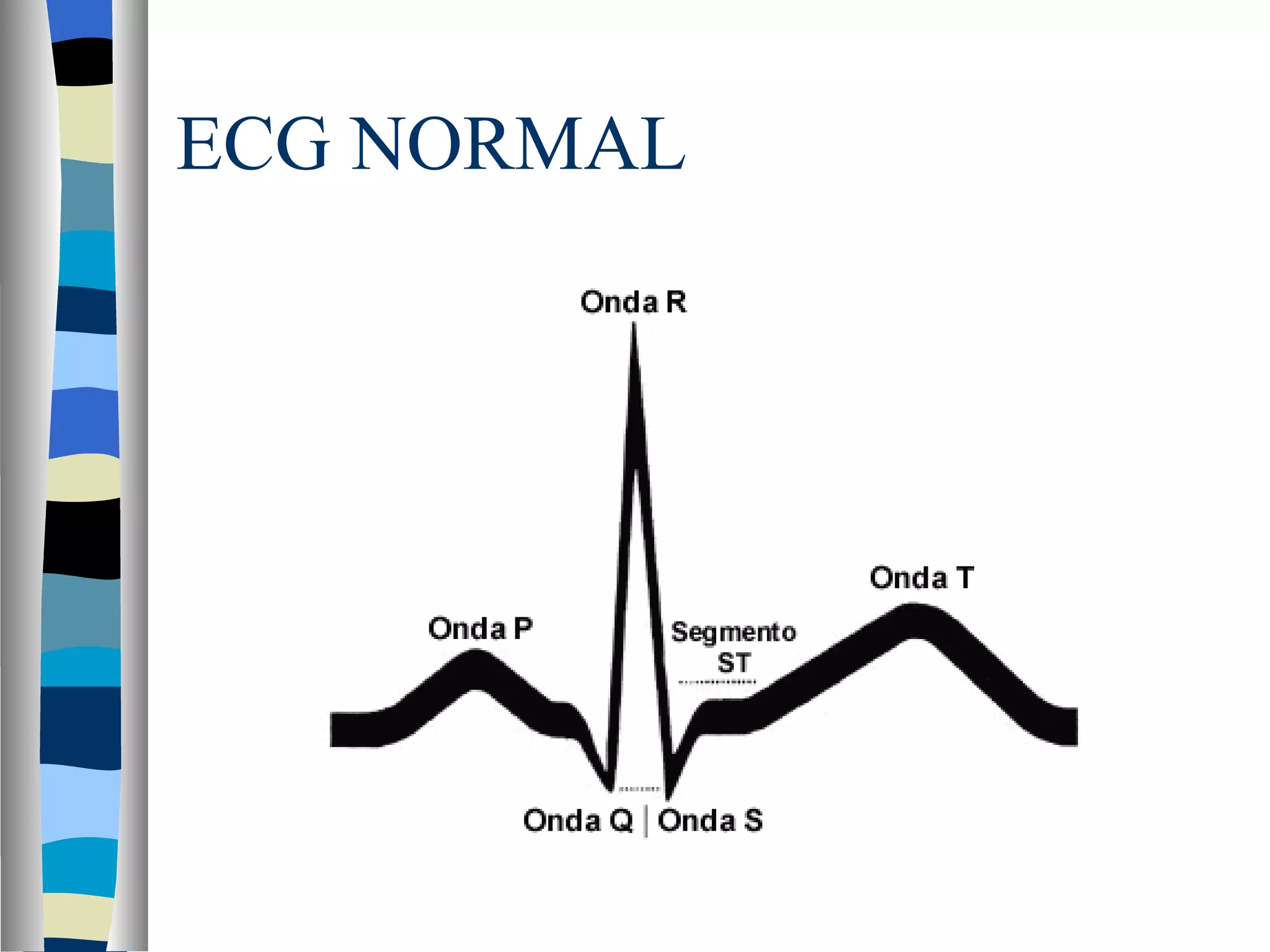 ECG NORMAL 