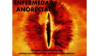 ENFERMEDAD
ANORECTAL
DR CARLOS MORENO MENDOZA
CIRUGIA GASTROINTESTINAL, BARIATRICA Y METABOLICA
 