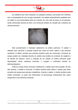 Os cateteres são muito utilizados na avaliação cardíaca, pois podem ser inseridos
sem a necessidade de uma cirurgia importante. Um cateter especialmente projetado com
um balão na sua extremidade pode ser inserido em uma veia do braço ou do pescoço,
sendo direcionado através do átrio e do ventrículo direitos do coração até a abertura da
válvula pulmonar.




         Este procedimento é chamado cateterismo da artéria pulmonar. O cateter é
utilizado para mensurar a pressão arterial dos vasos de maior calibre e nas câmaras
cardíacas. O débito cardíaco aos pulmões também pode ser mensurado. Amostras de
sangue podem ser coletadas através do cateter para análise do conteúdo de oxigênio e
de dióxido de carbono. Como a inserção de um cateter na artéria pulmonar pode
desencadear            ritmos        cardíacos          anormais,           o     coração         é     controlado           através        do
eletrocardiograma.
         Pode-se corrigir ritmos anormais mobilizando o cateter para outra posição. Se isto
não resolver, o cateter é removido. O médico também pode utilizar o cateter para obter
amostras de sangue para estudos metabólicos. Usando o cateter, o médico também pode
instilar contrastes, os quais são observados na fluoroscopia (radioscopia) dos vasos
sangüíneos e das câmaras cardíacas.




                                                                      47
Este material deve ser utilizado apenas como parâmetro de estudo deste Programa. Os créditos deste conteúdo são dados a seus respectivos autores
 