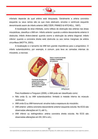 infartado depende de qual artéria está bloqueada. Geralmente a artéria coronária
esquerda ou seus ramos são os que mais obstruem, envolve o ventrículo esquerdo
denominando assim de infarto anterior (MELTZER, PINNEO & KITCHELL, 1997).
         A localização da área infartada, como reflexo de obstrução das artérias nas áreas
miocárdicas, classifica o IAM em: Infarto anterior: quando a artéria descendente anterior é
obstruída; Infarto Antero-lateral: quando ocorre a obstrução da artéria diagonal; Infarto
inferior: quando a coronária direita está obstruída ou aos ramos marginais da artéria
circunflexa (MOTTA, 2003).
         A localização e o tamanho da IAM tem grande importância para o prognóstico. O
infarto subendocárdico, por exemplo, é comum, pois leva as camadas internas do
miocárdio, a necrose.




         Para Huddleston e Ferguson (2006), o IAM pode ser classificado como:
         Não onda Q, ou IAM subendocárdico: limitado à metade interna do músculo
         ventricular;
         IAM onda Q ou IAM transmural: envolve toda a espessura do miocárdio;
         IAM anterior: artéria coronária descendente anterior esquerda ocluída. No ECG são
         observadas alterações em V2 até V4.
         IAM inferior ou diafragmático: artéria coronária direita ocluída. No ECG são
         observadas alterações em DII, DIII e aVF;




                                                                      92
Este material deve ser utilizado apenas como parâmetro de estudo deste Programa. Os créditos deste conteúdo são dados a seus respectivos autores
 