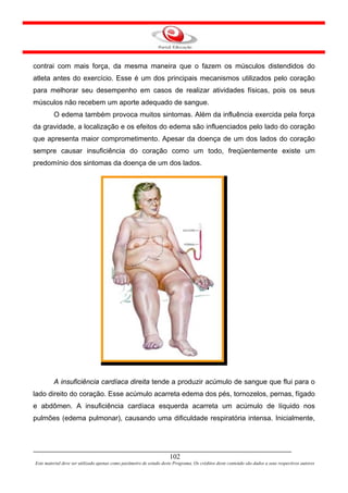 contrai com mais força, da mesma maneira que o fazem os músculos distendidos do
atleta antes do exercício. Esse é um dos principais mecanismos utilizados pelo coração
para melhorar seu desempenho em casos de realizar atividades físicas, pois os seus
músculos não recebem um aporte adequado de sangue.
         O edema também provoca muitos sintomas. Além da influência exercida pela força
da gravidade, a localização e os efeitos do edema são influenciados pelo lado do coração
que apresenta maior comprometimento. Apesar da doença de um dos lados do coração
sempre causar insuficiência do coração como um todo, freqüentemente existe um
predomínio dos sintomas da doença de um dos lados.




         A insuficiência cardíaca direita tende a produzir acúmulo de sangue que flui para o
lado direito do coração. Esse acúmulo acarreta edema dos pés, tornozelos, pernas, fígado
e abdômen. A insuficiência cardíaca esquerda acarreta um acúmulo de líquido nos
pulmões (edema pulmonar), causando uma dificuldade respiratória intensa. Inicialmente,




                                                                     102
Este material deve ser utilizado apenas como parâmetro de estudo deste Programa. Os créditos deste conteúdo são dados a seus respectivos autores
 