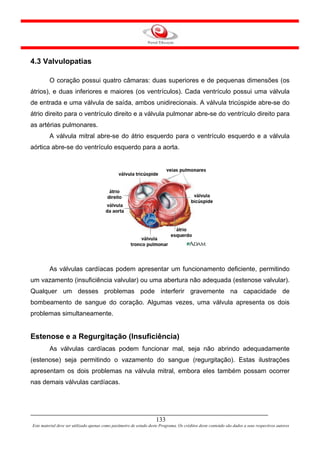 4.3 Valvulopatias

         O coração possui quatro câmaras: duas superiores e de pequenas dimensões (os
átrios), e duas inferiores e maiores (os ventrículos). Cada ventrículo possui uma válvula
de entrada e uma válvula de saída, ambos unidirecionais. A válvula tricúspide abre-se do
átrio direito para o ventrículo direito e a válvula pulmonar abre-se do ventrículo direito para
as artérias pulmonares.
         A válvula mitral abre-se do átrio esquerdo para o ventrículo esquerdo e a válvula
aórtica abre-se do ventrículo esquerdo para a aorta.




         As válvulas cardíacas podem apresentar um funcionamento deficiente, permitindo
um vazamento (insuficiência valvular) ou uma abertura não adequada (estenose valvular).
Qualquer um desses problemas pode interferir gravemente na capacidade de
bombeamento de sangue do coração. Algumas vezes, uma válvula apresenta os dois
problemas simultaneamente.


Estenose e a Regurgitação (Insuficiência)
         As válvulas cardíacas podem funcionar mal, seja não abrindo adequadamente
(estenose) seja permitindo o vazamento do sangue (regurgitação). Estas ilustrações
apresentam os dois problemas na válvula mitral, embora eles também possam ocorrer
nas demais válvulas cardíacas.




                                                                     133
Este material deve ser utilizado apenas como parâmetro de estudo deste Programa. Os créditos deste conteúdo são dados a seus respectivos autores
 