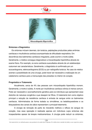 Miocardiopatia Hipertrófica


Sintomas e Diagnóstico
    Os sintomas incluem desmaio, dor torácica, palpitações produzidas pelas arritmias
cardíacas e insuficiência cardíaca acompanhada de dificuldade respiratória. Em
decorrência dos batimentos cardíacos irregulares, pode ocorrer a morte súbita.
Geralmente, o médico consegue diagnosticar a miocardiopatia hipertrófica através do
exame físico. Por exemplo, os sons cardíacos auscultados através de um estetoscópio
costumam ser característicos. Geralmente, o diagnóstico é confirmado por um
ecocardiograma, eletrocardiograma (ECG) ou por radiografia torácica. No caso do médico
aventar a possibilidade de uma cirurgia, pode haver ser necessário a realização de um
cateterismo cardíaco para a mensuração das pressões no interior do coração.


Prognóstico e Tratamento
         Anualmente, cerca de 4% das pessoas com miocardiopatia hipertrófica morrem.
Geralmente, a morte é súbita. A morte por insuficiência cardíaca crônica é menos comum.
Pode ser necessário o aconselhamento genético para os indivíduos que apresentam esse
distúrbio de natureza congênita e que desejam ter filhos. O tratamento tem como objetivo
principal a redução da resistência cardíaca à entrada de sangue entre os batimentos
cardíacos. Administrados de forma isolada ou simultânea, os betabloqueadores e os
bloqueadores dos canais de cálcio representam o principal tratamento.
         A cirurgia de remoção de parte do miocárdio melhora o refluxo do sangue do
coração, mas essa operação é realizada apenas em indivíduos cujos sintomas são
incapacitantes apesar da terapia medicamentosa. A cirurgia pode reduzir os sintomas,


                                                                     130
Este material deve ser utilizado apenas como parâmetro de estudo deste Programa. Os créditos deste conteúdo são dados a seus respectivos autores
 