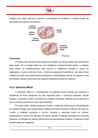 imagens que utiliza ultra-som, permite a visualização do prolapso e a determinação da
gravidade de qualquer insuficiência.




Tratamento
         A maioria dos indivíduos que apresenta prolapso da válvula mitral não necessita de
trata mento. Se o coração bater em uma freqüência excessivamente rápida, o paciente
pode utilizar um betabloqueador, para diminuir a freqüência cardíaca e reduzir as
palpitações e outros sintomas Caso o indivíduo apresente insuficiência, ele deve tomar
antibióticos antes de procedimentos cirúrgicos ou odontológicos devido ao pequeno risco
de infecção valvular decorrente das bactérias liberadas durante os mesmos.



4.3.3. Estenose Mitral
         A estenose mitral é o estreitamento da abertura dessa válvula que aumenta a
resistência ao fluxo sangüíneo do átrio esquerdo para o ventrículo esquerdo. Quase
sempre, a estenose mitral é resultante da moléstia reumática, afecção que atualmente é
rara na América do Norte e na Europa Ocidental.
         Por essa razão, nessas partes do mundo, a estenose mitral ocorre principalmente
em pessoas idosas que apresentaram moléstia reumática durante a infância. No resto do
mundo, a moléstia reumática é comum, levando à estenose mitral em adultos,
adolescentes e mesmo em crianças. Em geral, quando a moléstia reumática é a causa da
estenose, os folhetos da válvula mitral tornam-se parcialmente fundidos. A estenose mitral
também pode ser congênita.

                                                                     138
Este material deve ser utilizado apenas como parâmetro de estudo deste Programa. Os créditos deste conteúdo são dados a seus respectivos autores
 
