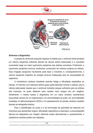 Sintomas e Diagnóstico
         A parede do ventrículo esquerdo espessa à medida que o ventrículo tenta bombear
um volume sangüíneo suficiente através da válvula aórtica estenosada e o miocárdio
aumentado exige um maior suprimento sangüíneo das artérias coronárias. Finalmente, o
suprimento sangüíneo torna-se insuficiente, produzindo dor torácica (angina) ao esforço.
Essa irrigação sangüínea insuficiente pode lesar o miocárdio e, consequentemente, o
volume sangüíneo originário do coração torna-se inadequado para as necessidades do
organismo.
         A insuficiência cardíaca resultante acarreta fadiga e dificuldade respiratória ao
esforço. O indivíduo com estenose aórtica grave pode desmaiar durante o esforço, pois a
válvula estenosada impede que o ventrículo bombeie sangue suficiente para as artérias
dos músculos, os quais dilataram para receber mais sangue rico em oxigênio.
Geralmente, o médico baseia o diagnóstico em um sopro cardíaco característico
(auscultado através de um estetoscópio), em anormalidades do pulso, em anormalidades
reveladas no eletrocardiograma (ECG) e no espessamento da parede cardíaca revelado
através da radiografia torácica.
         Para a identificação da causa e a de terminação da gravidade da estenose em
indivíduos que apresentam angina, dificuldade respiratória ou desmaios, a ecocardiografia
(técnica de diagnóstico por imagem utilizando ondas ultra-sônicas) e, possivelmente, o
cateterismo cardíaco podem ser utilizados.

                                                                     143
Este material deve ser utilizado apenas como parâmetro de estudo deste Programa. Os créditos deste conteúdo são dados a seus respectivos autores
 