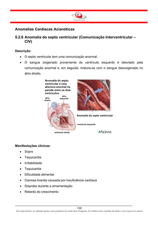 Anomalias Cardíacas Acianóticas

5.2.6 Anomalia do septo ventricular (Comunicação Interventricular –
      CIV)

Descrição:
    •    O septo ventricular tem uma comunicação anormal.
    •    O sangue oxigenado proveniente do ventrículo esquerdo é desviado pela
         comunicação anormal e, em seguida, mistura-se com o sangue desoxigenado no
         átrio direito.




Manifestações clínicas:
    •    Sopro
    •    Taquicardia
    •    Irritabilidade
    •    Taquicardia
    •    Dificuldade alimentar
    •    Cianose branda causada por insuficiência cardíaca
    •    Dispnéia durante a amamentação
    •    Retardo do crescimento




                                                                     166
Este material deve ser utilizado apenas como parâmetro de estudo deste Programa. Os créditos deste conteúdo são dados a seus respectivos autores
 