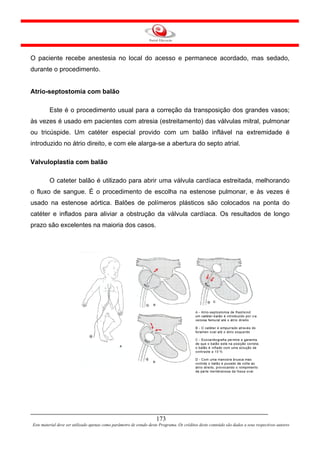 O paciente recebe anestesia no local do acesso e permanece acordado, mas sedado,
durante o procedimento.


Atrio-septostomia com balão

         Este é o procedimento usual para a correção da transposição dos grandes vasos;
às vezes é usado em pacientes com atresia (estreitamento) das válvulas mitral, pulmonar
ou tricúspide. Um catéter especial provido com um balão inflável na extremidade é
introduzido no átrio direito, e com ele alarga-se a abertura do septo atrial.

Valvuloplastia com balão

         O cateter balão é utilizado para abrir uma válvula cardíaca estreitada, melhorando
o fluxo de sangue. É o procedimento de escolha na estenose pulmonar, e às vezes é
usado na estenose aórtica. Balões de polímeros plásticos são colocados na ponta do
catéter e inflados para aliviar a obstrução da válvula cardíaca. Os resultados de longo
prazo são excelentes na maioria dos casos.




                                                                     173
Este material deve ser utilizado apenas como parâmetro de estudo deste Programa. Os créditos deste conteúdo são dados a seus respectivos autores
 