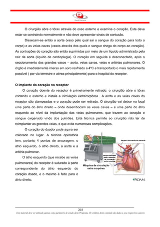 O cirurgião abre o tórax através do osso esterno e examina o coração. Este deve
estar se contraindo normalmente e não deve apresentar sinais de contusão.
         Dissecam-se então a aorta (vaso pelo qual sai o sangue do coração para todo o
corpo) e as veias cavas (vasos através dos quais o sangue chega do corpo ao coração).
As contrações do coração são então suprimidas por meio de um líquido administrado pela
raiz da aorta (líquido de cardioplegia). O coração em seguida é desconectado, após o
seccionamento dos grandes vasos – aorta, veias cavas, veias e artérias pulmonares. O
órgão é imediatamente imerso em soro resfriado a 4ºC e transportado o mais rapidamente
possível ( por via terrestre e aérea principalmente) para o hospital do receptor.


O implante do coração no receptor
      O coração doente do receptor é primeiramente retirado: o cirurgião abre o tórax
cortando o esterno e instala a circulação extracorpórea . A aorta e as veias cavas do
receptor são clampeadas e o coração pode ser retirado. O cirurgião vai deixar no local
uma parte do átrio direito – onde desembocam as veias cavas – e uma parte do átrio
esquerdo ao nível da implantação das veias pulmonares, que trazem ao coração o
sangue oxigenado vindo dos pulmões. Esta técnica permite ao cirurgião não ter de
reimplantar as grandes veias, o que evita numerosas complicações.
         O coração do doador pode agora ser
colocado no lugar. A técnica operatória
tem, portanto 4 pontos de ancoragem: o
átrio esquerdo, o átrio direito, a aorta e a
artéria pulmonar.
      O átrio esquerdo (que recebe as veias
pulmonares) do receptor é suturado à parte
correspondente             do      átrio      esquerdo           do
coração doado, e o mesmo é feito para o
átrio direito.




                                                                     203
Este material deve ser utilizado apenas como parâmetro de estudo deste Programa. Os créditos deste conteúdo são dados a seus respectivos autores
 
