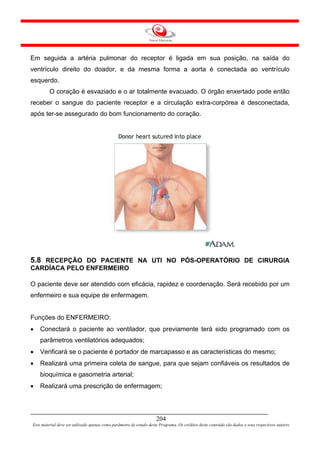 Em seguida a artéria pulmonar do receptor é ligada em sua posição, na saída do
ventrículo direito do doador, e da mesma forma a aorta é conectada ao ventrículo
esquerdo.
         O coração é esvaziado e o ar totalmente evacuado. O órgão enxertado pode então
receber o sangue do paciente receptor e a circulação extra-corpórea é desconectada,
após ter-se assegurado do bom funcionamento do coração.




5.8 RECEPÇÃO DO PACIENTE NA UTI NO PÓS-OPERATÓRIO DE CIRURGIA
CARDÍACA PELO ENFERMEIRO

O paciente deve ser atendido com eficácia, rapidez e coordenação. Será recebido por um
enfermeiro e sua equipe de enfermagem.


Funções do ENFERMEIRO:
•   Conectará o paciente ao ventilador, que previamente terá sido programado com os
    parâmetros ventilatórios adequados;
•   Verificará se o paciente é portador de marcapasso e as características do mesmo;
•   Realizará uma primeira coleta de sangue, para que sejam confiáveis os resultados de
    bioquímica e gasometria arterial;
•   Realizará uma prescrição de enfermagem;




                                                                     204
Este material deve ser utilizado apenas como parâmetro de estudo deste Programa. Os créditos deste conteúdo são dados a seus respectivos autores
 