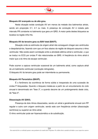 Bloqueio AV avançado ou de alto grau.
         Nesta situação existe condução AV em menos da metade dos batimentos atriais,
sendo em proporção 3:1, 4:1 ou mais. A presença de condução AV é notada pelo
intervalo PR constante no batimento que gera um QRS. A maior parte destes bloqueios se
localiza na região infra His.


Bloqueio AV do terceiro grau ou BAV total (BAVT).
         Situação onde os estímulos de origem atrial não conseguem chegar aos ventrículos
e despolarizá-los, fazendo com que um foco abaixo da região de bloqueio assuma o ritmo
ventricular. Não existe assim correlação entre a atividade elétrica atrial e ventricular, o que
se traduz no ECG por ondas P não relacionadas ao QRS. A freqüência do ritmo atrial é
maior que a do ritmo de escape ventricular.


Pode ocorrer a captura ventricular ocasional de um batimento atrial, como captura atrial
de um batimento ventricular (condução retrograda).
O bloqueio AV do terceiro grau pode ser intermitente ou permanente.


Bloqueio AV Paroxístico (BAVP).
         É o fenômeno da ocorrência de forma súbita e inesperada de uma sucessão de
ondas P bloqueadas. Quando o bloqueio instala-se a partir de um encurtamento do ciclo
sinusal é denominado em "fase 3", e quando decorre de um prolongamento deste ciclo,
de "fase 4".


Dissociação AV (DAV).
         Presença de dois ritmos dissociados, sendo um atrial e geralmente sinusal com PP
regular e outro com origem ventricular, sendo este com freqüência similar (dissociação
isorítmica) ou superior ao ritmo atrial.
O ritmo ventricular pode ser hiperautomático e de substituição.




                                                                     255
Este material deve ser utilizado apenas como parâmetro de estudo deste Programa. Os créditos deste conteúdo são dados a seus respectivos autores
 