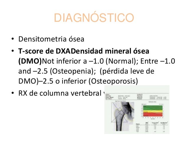 Dolor de cabeza hormonal tratamiento Dolor de cabeza hormonal tratamiento