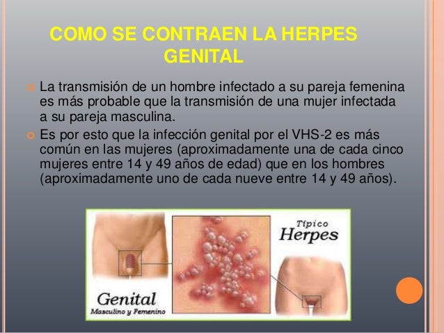 La psoriasis sobre la persona alrededor de los ojos