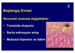 Ba(lang ç EvresiBaBa((langlang çç EvresiEvresi
ReversiblReversibl mukozalmukozal dede44ii((iklikleriklikler ::
•• TransTransüüdada oluolu((umuumu
•• SerSeröözz sekresyonsekresyon artart ((
•• MukozalMukozal hiperemihiperemi veve öödemdem
 