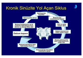 OstiumOstium kapankapan rr
Kronik Sinüzite Yol Açan SiklusKronik SinKronik Sinüüzite Yol Azite Yol Aççanan SiklusSiklus
SekresyonlarSekresyonlar
koyulakoyula(( rr
SekresyonlarSekresyonlar akmazakmaz
MukozaMukoza konjeksiyonukonjeksiyonu ya daya da
anatomik obstranatomik obstrüüksiyon havaksiyon hava
akak mm nn ve drenajve drenaj bloke ederbloke eder
MukozalMukozal gazgaz
metabolizmasmetabolizmas dede44ii((irir
SiliaSilia veve epitelepitel
hasara uhasara u44rarrar
BakteriBakteri üüremesi iremesi iççinin
kküültltüür ortamr ortam oluolu((urur
OluOlu((anan sekresyonlarsekresyonlar
dokudoku inflamasyonunainflamasyonuna
neden olurneden olur
SinSinüüs bos bo((lulu44unda bakteriunda bakteri
infeksiyonuinfeksiyonu geligeli((irir
MukozalMukozal kalkal nlanla((ma dahama daha
fazla blokaj olufazla blokaj olu((tururturur
 