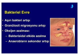 Bakteriel EvreBakterielBakteriel EvreEvre
•• AA(( rr bakteribakteri artart ((
•• GranGranüülositlosit migrasyonumigrasyonu artart ((
•• OksijenOksijen azalmasazalmas ::
–– BBakterisidalakterisidal etkideetkide azalmaazalma
–– AnaeroblarAnaeroblar nn sekondersekonder artart ((
 