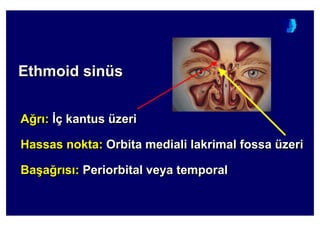 Ethmoid sinüsEtEthhmoidmoid sinsinüüss
A4r : :ç kantus üzeri
Hassas nokta: Orbita mediali lakrimal fossa üzeri
Ba(a4r s : Periorbital veya temporal
AA44rr :: ::çç kantuskantus üüzerizeri
HassasHassas noktanokta:: Orbita medialOrbita medialii lakrimallakrimal fossafossa üüzerizeri
BaBa((aa44rr ss :: PeriorbitalPeriorbital veyaveya temporaltemporal
 