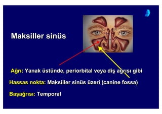 Maksiller sinüsMaksillerMaksiller sinsinüüss
A4r : Yanak üstünde, periorbital veya di( a4r s gibi
Hassas nokta: Maksiller sinüs üzeri (canine fossa)
Ba(a4r s : Temporal
AA44rr :: YanakYanak üüststüündende, periorbital, periorbital veyaveya didi(( aa44rr ss gibigibi
HassasHassas noktanokta:: MaksillerMaksiller sinsinüüss üüzerizeri ((canine fossacanine fossa))
BaBa((aa44rr ss :: TemporalTemporal
 
