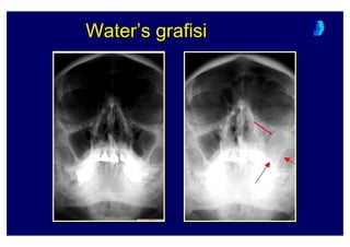 Water’s grafisiWaterWater’’ss grafisigrafisi
 