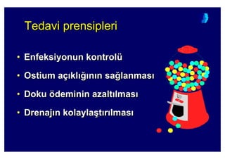 Tedavi prensipleriTedavi prensipleriTedavi prensipleri
• Enfeksiyonun kontrolü
• Ostium aç kl 4 n n sa4lanmas
• Doku ödeminin azalt lmas
• Drenaj n kolayla(t r lmas
•• Enfeksiyonun kontrolEnfeksiyonun kontrolüü
•• OstiumOstium aaçç klkl 44 nn n san sa44lanmaslanmas
•• DokuDoku öödeminin azaltdeminin azalt lmaslmas
•• DrenajDrenaj n kolaylan kolayla((tt rr lmaslmas
 