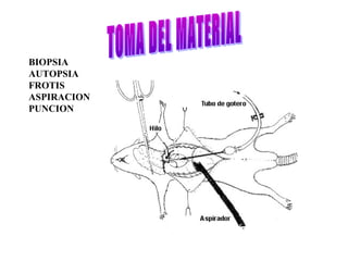 BIOPSIA
AUTOPSIA
FROTIS
ASPIRACION
PUNCION
 