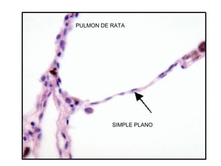 PULMON DE RATA
SIMPLE PLANO
 