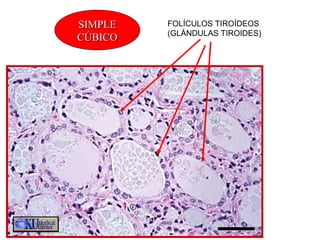 SIMPLESIMPLE
CÚBICOCÚBICO
FOLÍCULOS TIROIDEOS
(glándula tiroides)
FOLÍCULOS TIROÍDEOS
(GLÁNDULAS TIROIDES)
 