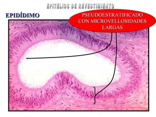 PSEUDOESTRATIFICADOPSEUDOESTRATIFICADO
CON MICROVELLOSIDADESCON MICROVELLOSIDADES
LARGASLARGAS
EPIDÍDIMOEPIDÍDIMO
 