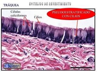 PSEUDOESTRATIFICADOPSEUDOESTRATIFICADO
CON CILIOSCON CILIOS
TRÁQUEATRÁQUEA
Cilios
Células
caliciformes
 