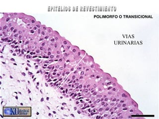 VIAS
URINARIAS
POLIMORFO O TRANSICIONAL
 
