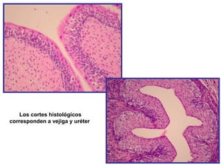 Los cortes histológicos
corresponden a vejiga y uréter
 