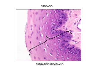 ESOFAGO
ESTRATIFICADO PLANO
 