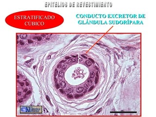 ESTRATIFICADOESTRATIFICADO
CÚBICOCÚBICO
CONDUCTO EXCRETOR DECONDUCTO EXCRETOR DE
GLÁNDULA SUDORÍPARAGLÁNDULA SUDORÍPARA
 