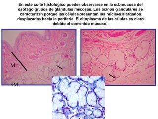 En este corte histológico pueden observarse en la submucosa del
esófago grupos de glándulas mucosas. Los acinos glandulares se
caracterizan porque las células presentan los núcleos alargados
desplazados hacia la periferia. El citoplasma de las células es claro
debido al contenido mucoso.
M
SM
 
