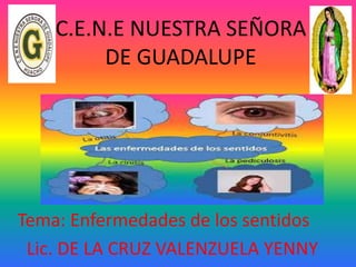 C.E.N.E NUESTRA SEÑORA
DE GUADALUPE
Tema: Enfermedades de los sentidos
Lic. DE LA CRUZ VALENZUELA YENNY
 