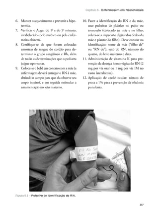 Capítulo 6 - Enfermagem em Neonatologia
357
6. Manter o aquecimento e prevenir a hipo-
termia.
7. Veriicar o Apgar do 1o
e do 5o
minuto,
estabelecidos pelo médico ou pela enfer-
meira obstetra.
8. Certiique-se de que foram coletadas
amostras de sangue do cordão para de-
terminar o grupo sangüíneo e Rh, além
de todas as determinações que o pediatra
julgue oportunas.
9. Coloca-se o bebê em contato com a mãe (a
enfermagem deverá entregar o RN à mãe,
abrindo o campo para que ela observe seu
corpo inteiro), e em seguida estimular a
amamentação no seio materno.
10. Fazer a identiicação do RN e da mãe,
usar pulseiras de plástico no pulso ou
tornozelo (colocado na mãe e no ilho,
coleta-se a impressão digital dos dedos da
mãe e plantar do ilho). Deve constar na
identiicação: nome da mãe (“ilho de”
ou “RN de”), sexo do RN, número do
quarto, do leito materno e data.
11. Administração de vitamina K para pre-
venção da doença hemorrágica do RN (2
mg por via oral ou 1 mg por via IM no
vasto lateral/coxa).
12. Aplicação de credê ocular: nitrato de
prata a 1% para a prevenção da oftalmia
purulenta.
Figura 6.1 – Pulseira de identiﬁcação do RN.
 