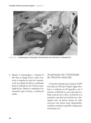 Tratado Prático de Enfermagem - volume 2
360
4. Quanto à armazenagem, a vitamina K
deve icar ao abrigo da luz e calor. Con-
servar as ampolas na caixa até o momen-
to do uso; depois de aberta, a medicação
pode ser utilizada em até 12 horas se pro-
tegida da luz. (Motivo: a medicação é fo-
tossensível; após 12 horas, a vitamina K
oxida.)
Avaliação da Vitalidade
do Recém-nascido
O método utilizado para avaliação do RN
foi criado em 1952 por Virgínia Apgar. Rea-
liza-se a avaliação aos 60 segundos e aos 5
minutos, atribuindo-se, para cada sinal ava-
liado, notas de zero a dois e no inal faz-se o
somatório, que dará um total de zero a dez.
Aqueles que, no quinto minuto de vida,
estiverem com baixas notas (deprimidos),
receberão assistência especíica (oxigenação,
reanimação etc.).
B
Figura 6.2 – (continuação) Aplicação intramuscular de vitamina K (Kanakion®
).
 