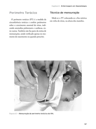 Capítulo 6 - Enfermagem em Neonatologia
367
Perímetro Torácico
O perímetro torácico (PT) é a medida da
circunferência torácica e confere parâmetros
sobre o crescimento anormal do tórax, indi-
cando anomalias pulmonares e cardíacas, en-
tre outras. Também não faz parte da rotina de
mensurações, sendo veriicado apenas no mo-
mento do nascimento ou quando prescrito.
Técnica de mensuração
Mede-se o PT colocando-se a ita métrica
em volta do tórax, na altura dos mamilos.
Figura 6.7 – Mensuração do perímetro torácico do RN.
 