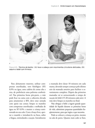 Capítulo 6 - Enfermagem em Neonatologia
369
Para aleitamento materno, utilizar com-
pressas esterilizadas, soro isiológico (SF)
0,9% ou água, uma cadeira de costas alta e
reta, de preferência uma poltrona confortá-
vel. Nas primeiras horas pós-parto, a mãe
pode icar na cama com a cabeceira elevada
para amamentar o RN, deve estar sentada
com apoio nas costas; limpar os mamilos
com compressas esterilizadas e molhadas de
água ou SF 0,9% e manter a criança semi-
sentada no seu colo. Com o braço livre, aper-
tar o mamilo e introduzi-lo na boca, sobre
a língua, estimulando a sucção. Inicialmente
a mamada deve durar 10 minutos em cada
mama, devendo sempre começar pelo último
seio da mamada anterior para facilitar o es-
vaziamento completo. Depois das primeiras
mamadas vai se acrescentando o tempo de
sucção do bebê (15-20 minutos cada seio). A
mãe deve limpar os mamilos no inal.
Não obrigue o bebê a ingerir grande quan-
tidade de líquido durante as primeiras horas
de vida, administre pequenas quantidades fre-
qüentemente, para que ingira o que necessita.
Pode-se colocar a criança ao peito, mesmo
na sala de parto. Quanto mais cedo se izer,
Figura 6.8 – Técnica do banho: (A) lave a cabeça com movimentos circulares delicados, (B)
segure o bebê com ﬁrmeza.
A B
 