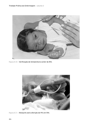 Tratado Prático de Enfermagem - volume 2
374
Figura 6.10 – Veriﬁcação da temperatura axilar do RN.
Figura 6.11 – Manguito para aferição de PA em RN.
 