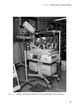 Capítulo 6 - Enfermagem em Neonatologia
383
Figura 6.12 – Bilispot: utilizado em fototerapia. A luz incide sobre o recém-nascido.
 