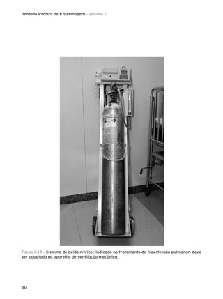 Tratado Prático de Enfermagem - volume 2
384
Figura 6.13 – Sistema de óxido nítrico: indicado no tratamento da hipertensão pulmonar, deve
ser adaptado ao aparelho de ventilação mecânica.
 