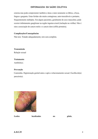 ENFERMAG E M EM SAÚDE COLETIVA

externa mas pode comprometer também o ânus e mais raramente os lábios, a boca,
língua e garganta. Estas feridas são muito contagiosas, auto-inoculáveis e portanto,
frequentemente múltiplas. Em alguns pacientes, geralmente do sexo masculino, pode
ocorrer infartamento ganglionar na região inguino-crural (inchação na virilha). Não é
rara a associação do cancro mole e o cancro duro (sífilis primária).


Complicações/Consequências
Não tem. Tratado adequadamente, tem cura completa.




Transmissão
Relação sexual


Tratamento
Antibiótico.


Prevenção
Camisinha. Higienização genital antes e após o relacionamento sexual. Escolha do(a)
parceiro(a).




Lesões                localizadas                 no                   pênis.




A.M.C.R                                                                                 4
 