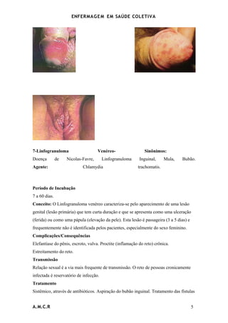 ENFERMAG E M EM SAÚDE COLETIVA




7-Linfogranuloma                     Venéreo-                 Sinônimos:
Doença         de   Nicolas-Favre,      Linfogranuloma     Inguinal,     Mula,   Bubão.
Agente:                     Chlamydia                     trachomatis.



Período de Incubação
7 a 60 dias.
Conceito: O Linfogranuloma venéreo caracteriza-se pelo aparecimento de uma lesão
genital (lesão primária) que tem curta duração e que se apresenta como uma ulceração
(ferida) ou como uma pápula (elevação da pele). Esta lesão é passageira (3 a 5 dias) e
frequentemente não é identificada pelos pacientes, especialmente do sexo feminino.
Complicações/Consequências
Elefantíase do pênis, escroto, vulva. Proctite (inflamação do reto) crônica.
Estreitamento do reto.
Transmissão
Relação sexual é a via mais frequente de transmissão. O reto de pessoas cronicamente
infectada é reservatório de infecção.
Tratamento
Sistêmico, através de antibióticos. Aspiração do bubão inguinal. Tratamento das fístulas


A.M.C.R                                                                                  5
 