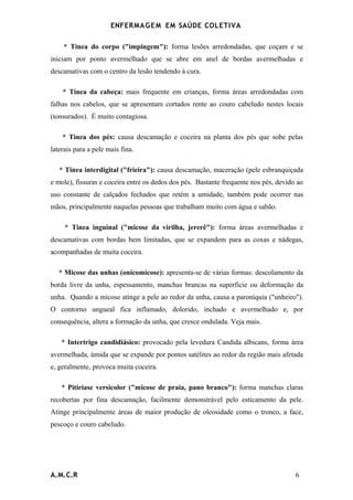 ENFERMAG E M EM SAÚDE COLETIVA

    * Tinea do corpo ("impingem"): forma lesões arredondadas, que coçam e se
iniciam por ponto avermelhado que se abre em anel de bordas avermelhadas e
descamativas com o centro da lesão tendendo à cura.

    * Tinea da cabeça: mais frequente em crianças, forma áreas arredondadas com
falhas nos cabelos, que se apresentam cortados rente ao couro cabeludo nestes locais
(tonsurados). É muito contagiosa.

    * Tinea dos pés: causa descamação e coceira na planta dos pés que sobe pelas
laterais para a pele mais fina.

   * Tinea interdigital ("frieira"): causa descamação, maceração (pele esbranquiçada
e mole), fissuras e coceira entre os dedos dos pés. Bastante frequente nos pés, devido ao
uso constante de calçados fechados que retém a umidade, também pode ocorrer nas
mãos, principalmente naquelas pessoas que trabalham muito com água e sabão.

     * Tinea inguinal ("micose da virilha, jererê"): forma áreas avermelhadas e
descamativas com bordas bem limitadas, que se expandem para as coxas e nádegas,
acompanhadas de muita coceira.

   * Micose das unhas (onicomicose): apresenta-se de várias formas: descolamento da
borda livre da unha, espessamento, manchas brancas na superfície ou deformação da
unha. Quando a micose atinge a pele ao redor da unha, causa a paroníquia ("unheiro").
O contorno ungueal fica inflamado, dolorido, inchado e avermelhado e, por
consequência, altera a formação da unha, que cresce ondulada. Veja mais.

    * Intertrigo candidiásico: provocado pela levedura Candida albicans, forma área
avermelhada, úmida que se expande por pontos satélites ao redor da região mais afetada
e, geralmente, provoca muita coceira.

    * Pitiríase versicolor ("micose de praia, pano branco"): forma manchas claras
recobertas por fina descamação, facilmente demonstrável pelo esticamento da pele.
Atinge principalmente áreas de maior produção de oleosidade como o tronco, a face,
pescoço e couro cabeludo.




A.M.C.R                                                                               6
 