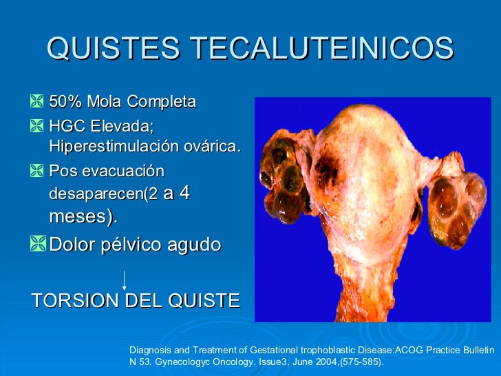 Tratamiento de quistes tecaluteinicos