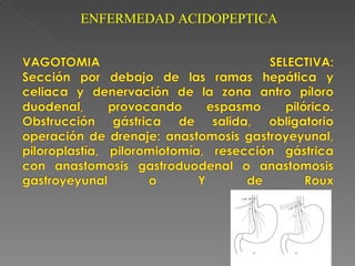 ENFERMEDAD ACIDOPEPTICA
 
