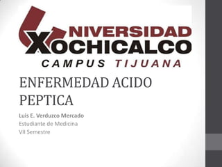 ENFERMEDAD ACIDO
PEPTICA
Luis E. Verduzco Mercado
Estudiante de Medicina
VII Semestre
 