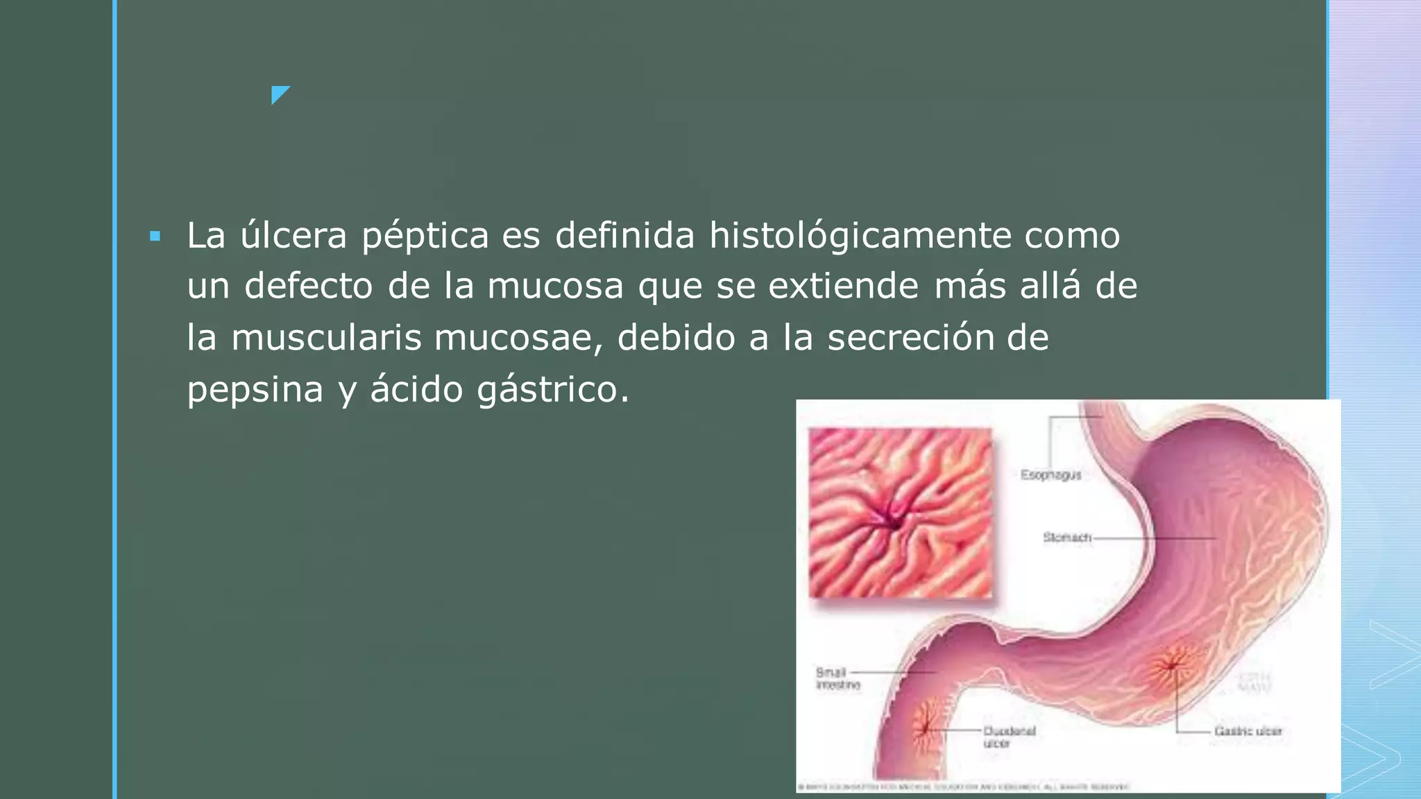 Enfermedad acido peptica SEDENA.pdf