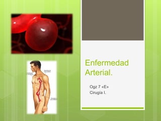 Enfermedad
Arterial.
Ogz 7 «E»
Cirugía I.
 